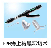PPH痔上粘膜环切术
